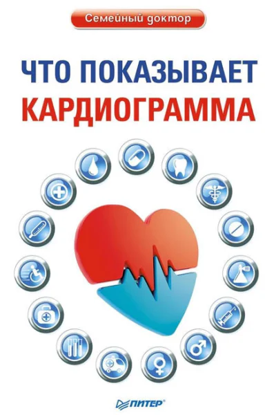 Что показывает кардиограмма