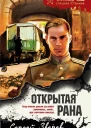 Открытая рана