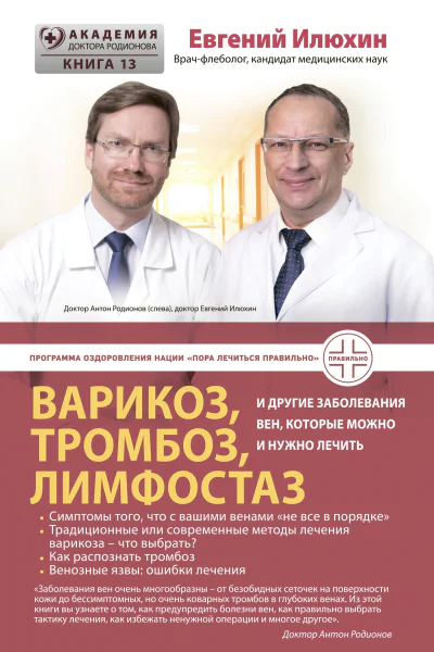 Варикоз тромбоз лимфостаз и другие заболевания вен которые можно и нужно лечить